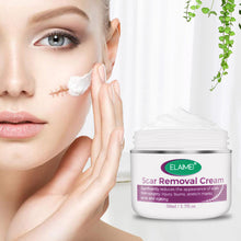 Scar Removal Cream