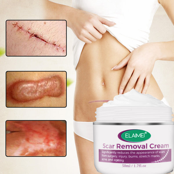 Scar Removal Cream